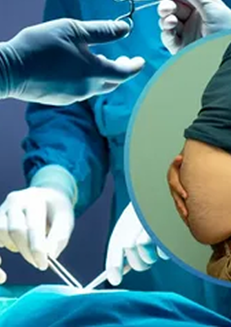Surgical Procedure